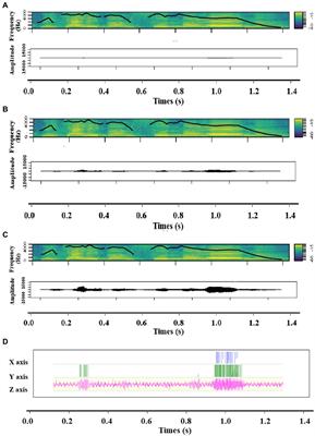 Influence of bodily resonances on emotional prosody perception